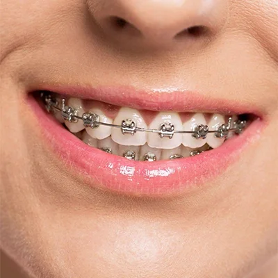 Chowdhury's Premium Dental Orthodontic Treatment slider 1