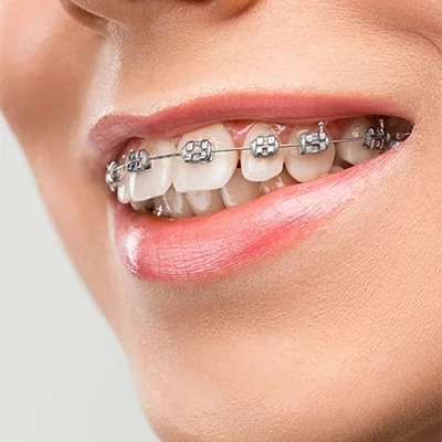 Chowdhury's Premium Dental Orthodontic Treatment slider 3