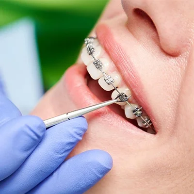 Chowdhury's Premium Dental Orthodontic Treatment slider 4