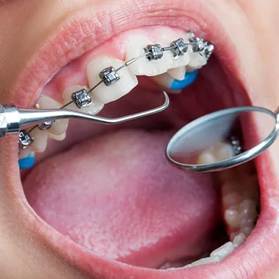 Chowdhury's Premium Dental Orthodontic Treatment slider 5