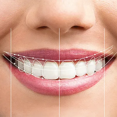 Chowdhury's Premium Dental Smile Design 1