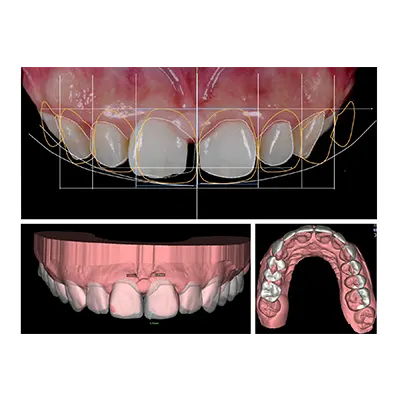 Chowdhury's Premium Dental Smile Design 2