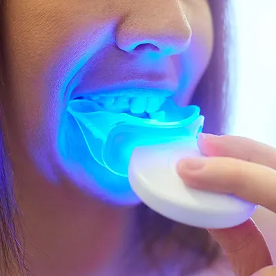 Chowdhury's Premium Dental Tooth Whitening 1