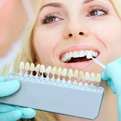 Chowdhury's Premium Dental Tooth Whitening 3