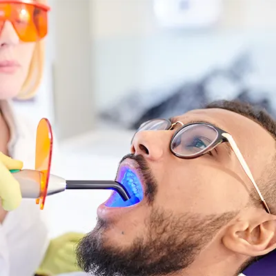 Chowdhury's Premium Dental Tooth Whitening 5