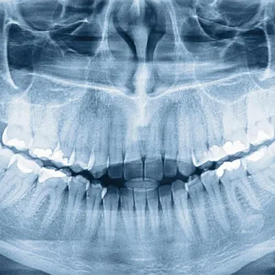 Chowdhury's Premium Dental x-ray 1