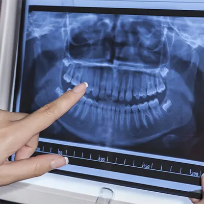 Chowdhury's Premium Dental x-ray 3
